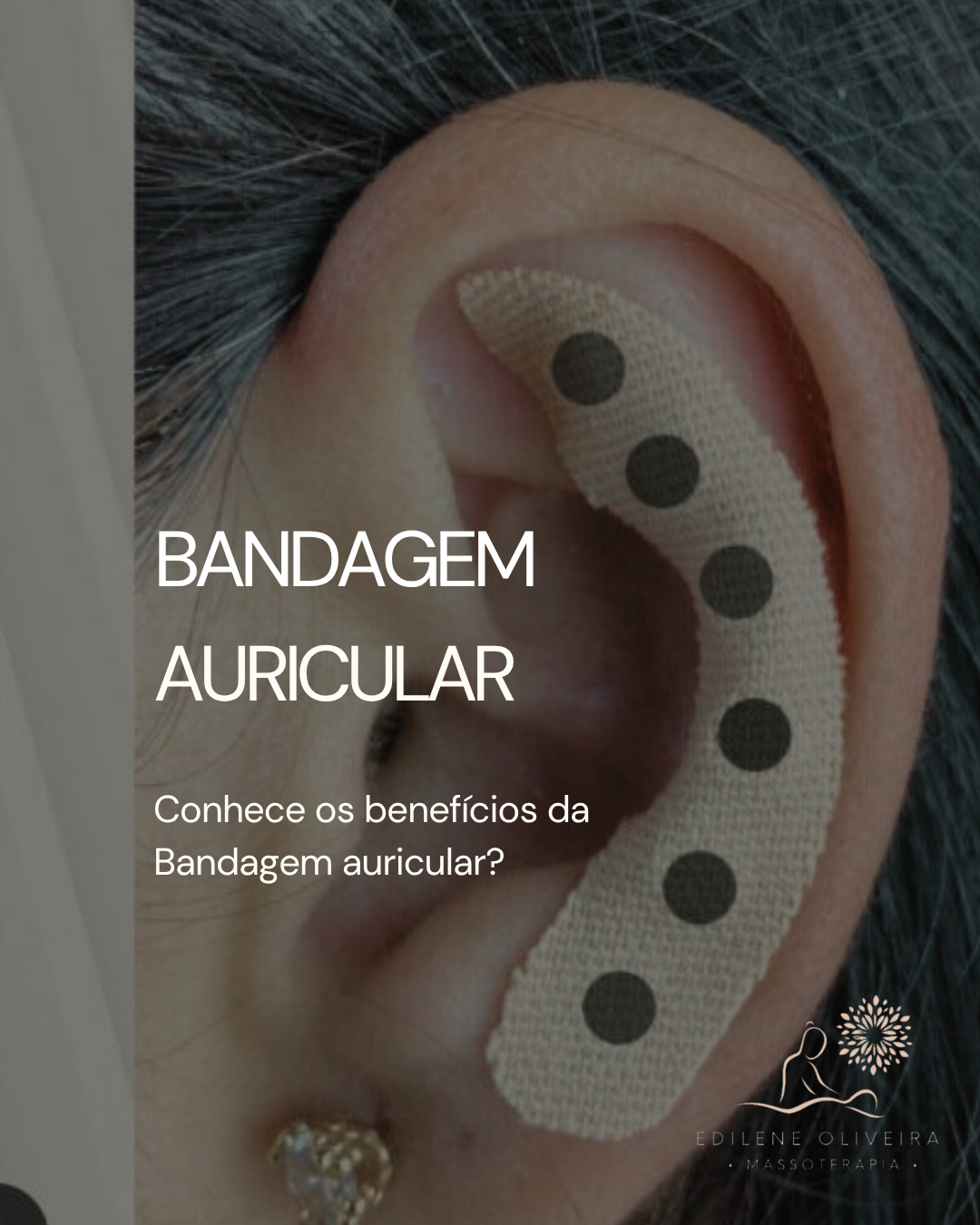 A bandagem auricular magnética é uma terapia complementar auxilia do tratamento das dores: dores de cabeça, exaqueca, dores no joelho, dores na lombar,cervical e ciático, fascite plantar, endometriose, cólica menstrual,bruxismo, ansiedade e insônia.
Essa terapia complementar é feita através de bandagem magnética, colocada em pontos específicos na orelha.